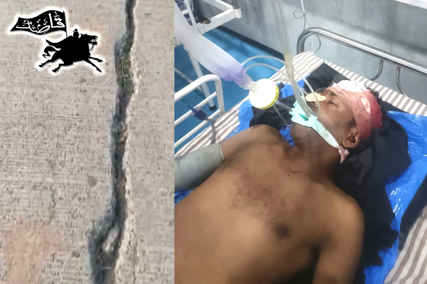 चिखली–मेहकर सिमेंट मार्ग ठरतोय “मृत्यूचा सापळा” रस्त्यावरील भेगेत अडकून दुचाकीचा अपघात, दुचाकीस्वार गंभीर जख्मी